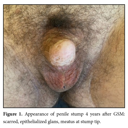 gl_306202644341764.jpg